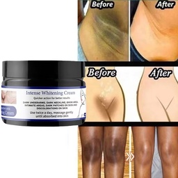 Intense whitening cream
